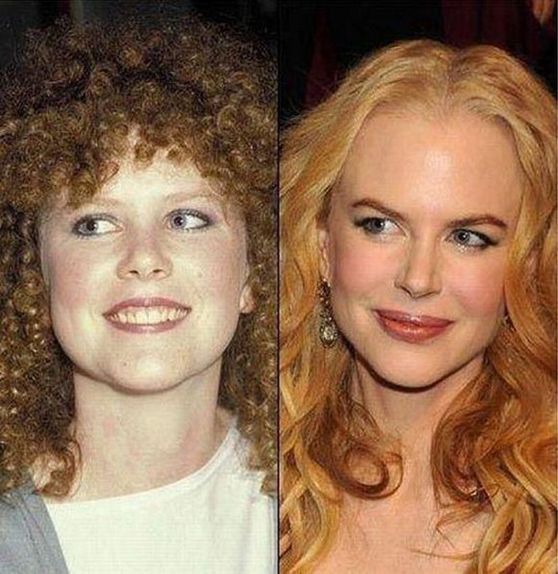 kidman